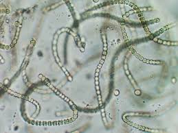 Attēlu rezultāti vaicājumam “Nostoc pruniforme cells”