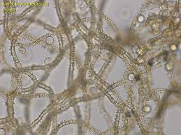 Attēlu rezultāti vaicājumam “Heterotrichia obvelata (syn. Arcyria obvelata) young”