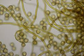 Attēlu rezultāti vaicājumam “Trichia sp.”