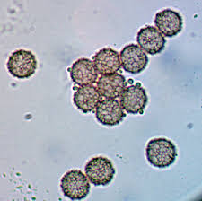 Attēlu rezultāti vaicājumam “Stemonitopsis amoena stalked”