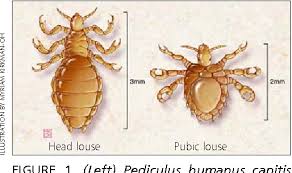 Attēlu rezultāti vaicājumam “Pediculus humanus capitis”