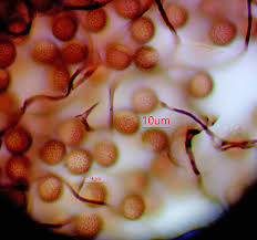 Attēlu rezultāti vaicājumam “Comatricha alta macro”