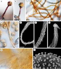 Attēlu rezultāti vaicājumam “Trichia botrytis var. cerifera spores”