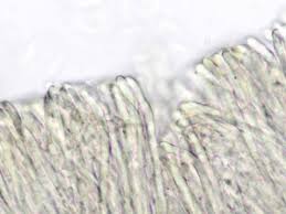 Attēlu rezultāti vaicājumam “Mollisia amenticola”