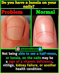 Image result for lunula nail