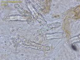 Attēlu rezultāti vaicājumam “Steccherinum fimbriatum”