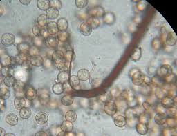 Attēlu rezultāti vaicājumam “Reticularia lobata spores”