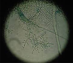 Attēlu rezultāti vaicājumam “Trichia longipalpis spores”