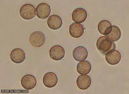 Attēlu rezultāti vaicājumam “Physarum luteolum spores”