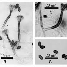 Attēlu rezultāti vaicājumam “Badhamia affinis var. microspora spores”