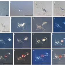 Attēlu rezultāti vaicājumam “Didymium annulisporum sessile”
