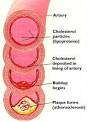 http://cholesterol-levels.com/wp-content/uploads/2010/05/Cholesterol-Levels.jpg