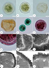 Attēlu rezultāti vaicājumam “Enteridium liceoides spores”