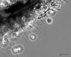 Attēlu rezultāti vaicājumam “Ceratiomyxa fruticulosa spores”
