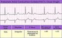 <b>premature atrial complexes</b>