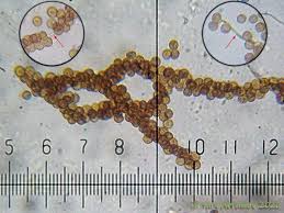 Attēlu rezultāti vaicājumam “Tubifera applanata spores”