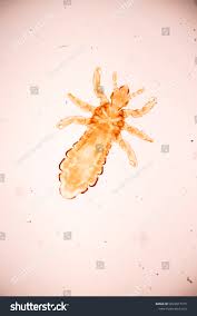 Attēlu rezultāti vaicājumam “Pediculus humanus capitis”