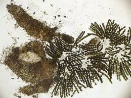 Attēlu rezultāti vaicājumam “Sordaria fimicola”