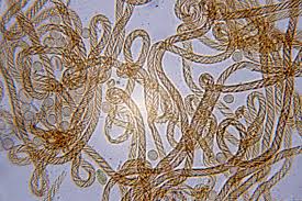 Attēlu rezultāti vaicājumam “Hemitrichia calyculata”