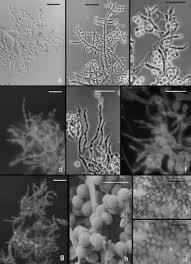 Attēlu rezultāti vaicājumam “Hypocrea rufa”