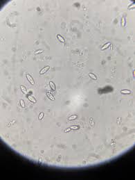 Attēlu rezultāti vaicājumam “Hymenoscyphus sp.”