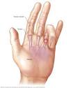 Trigger finger - Symptoms and causes - Mayo Clinic