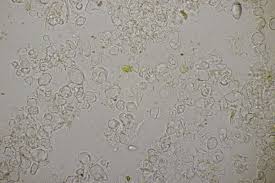 Attēlu rezultāti vaicājumam “Erythricium aurantiacum”