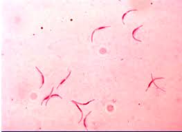 Attēlu rezultāti vaicājumam “Enteridium olivaceum plasmodium”