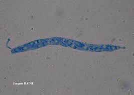 Attēlu rezultāti vaicājumam “Coenogonium pineti”