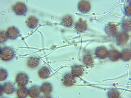 Attēlu rezultāti vaicājumam “Physarum diderma”