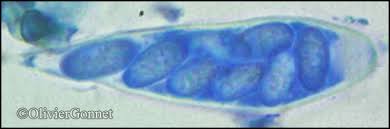 Attēlu rezultāti vaicājumam “Xylographa paralella”