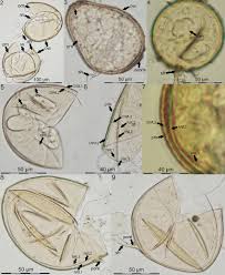 Attēlu rezultāti vaicājumam “Gulielmina vermicularis spores”