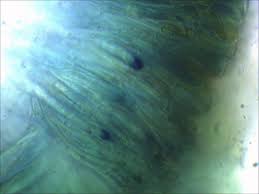 Attēlu rezultāti vaicājumam “Biatora sphaeroides”