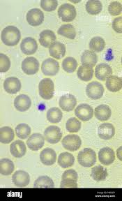 Attēlu rezultāti vaicājumam “Brefeldia maxima plasmodium”