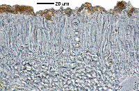 Attēlu rezultāti vaicājumam “Lecanora carpinea”