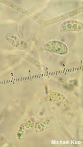 Attēlu rezultāti vaicājumam “Dacrymyces chrysospermus spores”