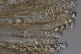 Attēlu rezultāti vaicājumam “Peziza ammophila”