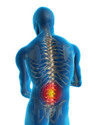  severe Back Pain