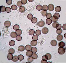 Attēlu rezultāti vaicājumam “Badhamia lilacina”