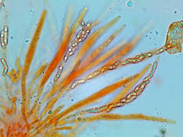 Attēlu rezultāti vaicājumam “Ruzenia spermoides”