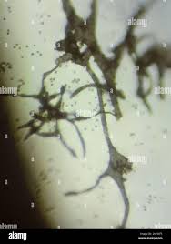 Attēlu rezultāti vaicājumam “Lycogala flavofuscum sessile”