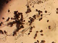 Attēlu rezultāti vaicājumam “Physaraceae”