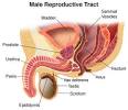  Prostate Cancer : Overview | Health Library | Weill Cornell ... 
