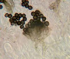 Attēlu rezultāti vaicājumam “Xanthoriicola physciae”