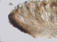 Attēlu rezultāti vaicājumam “Xylographa paralella”