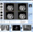 Santesoft - Sante DICOM Applications