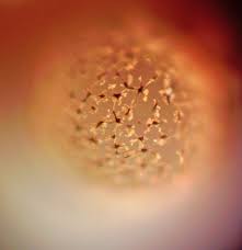 Attēlu rezultāti vaicājumam “Cribraria costata spores”