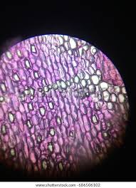 Attēlu rezultāti vaicājumam “Leiocolea rutheana cells”