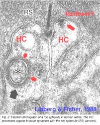 Attēlu rezultāti vaicājumam “Leiocolea rutheana cells”