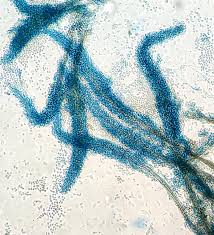 Attēlu rezultāti vaicājumam “Isothecium alopecuroides sporophyte”